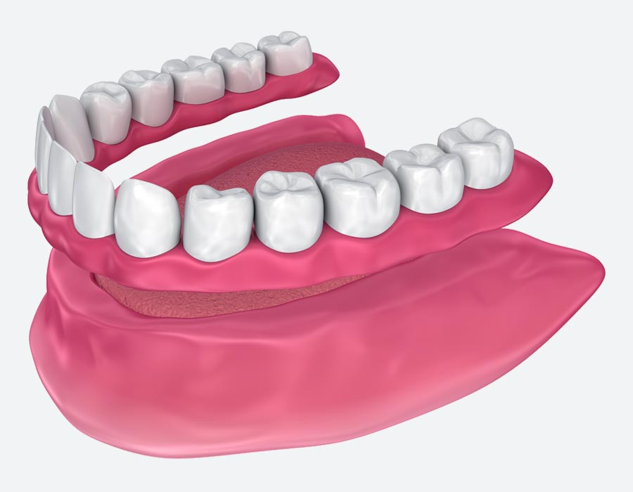 Full denture Full denture